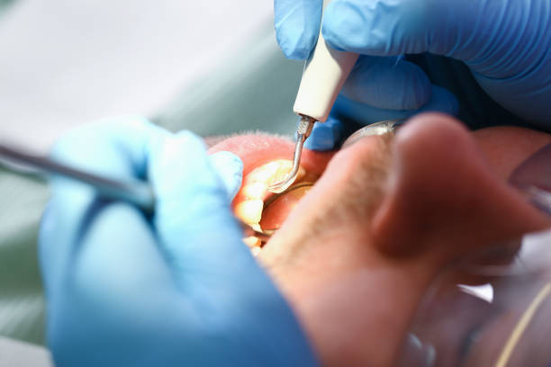Best Chipped Tooth Repair Near Me  in Pond Creek, OK