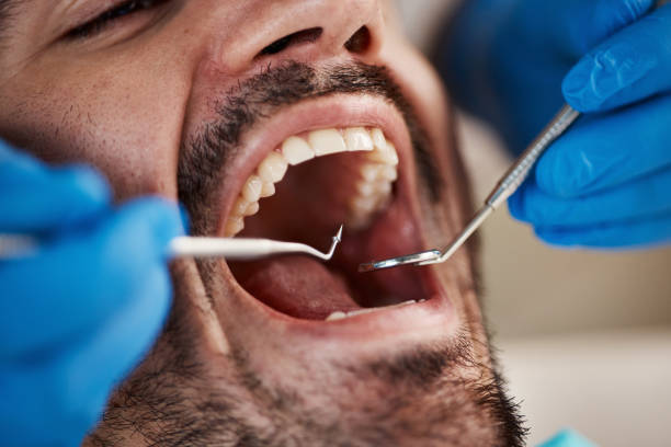 Best Affordable Emergency Dental Care  in Pond Creek, OK