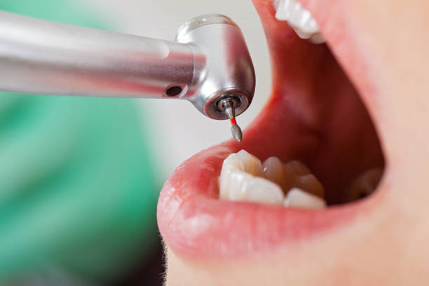 Best Emergency Dentist No Insurance  in Pond Creek, OK